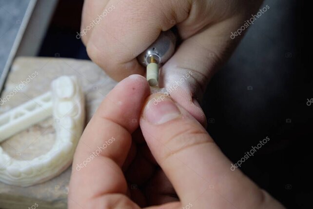 Controllo qualità nel laboratorio odontotecnico