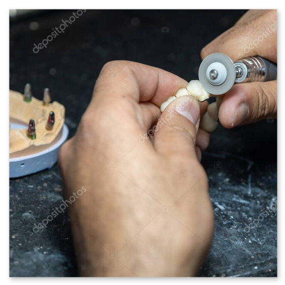 Fresatrice in funzione su zirconia