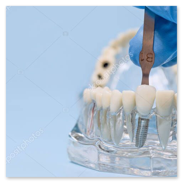 Controllo tinta e caratterizzazioni estetiche