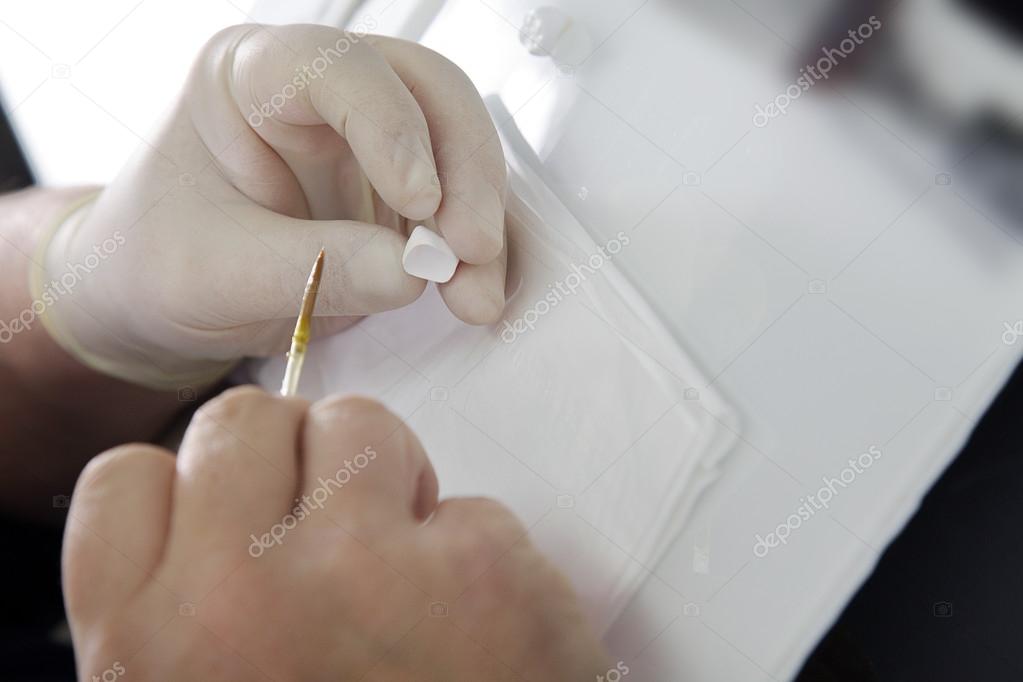 Corone e ponti in zirconia multistrato