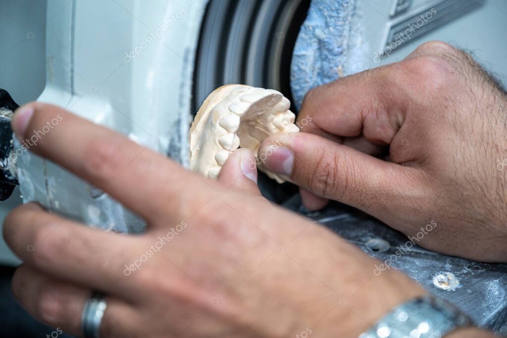 Corone e ponti in zirconia di alta precisione